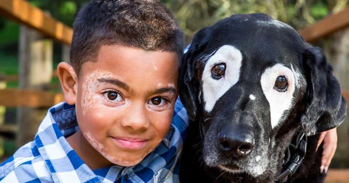 8-åringen har en hudsykdom og er deprimert. Men se hva som skjer etter møtet med DENNE hunden!